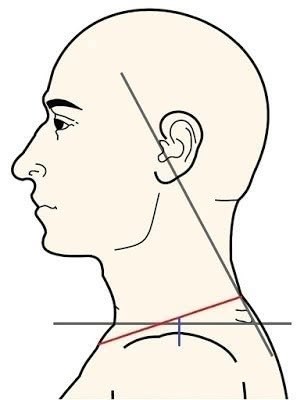 ​"Японское" плечо