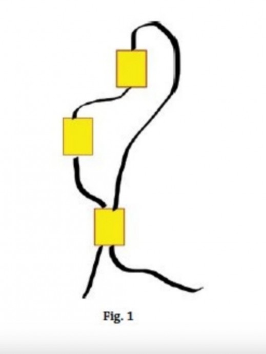 Кирпичный стежок