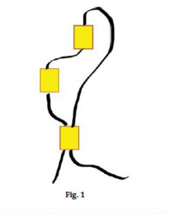 Кирпичное плетение